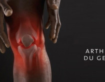 Arthrose du genou
